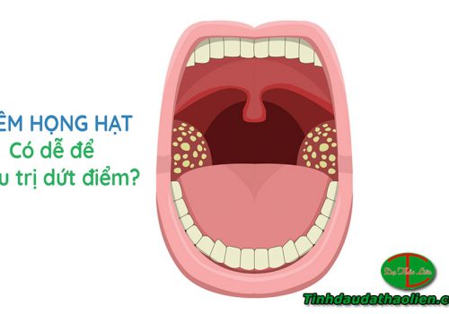 Viêm họng hạt