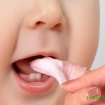 Bệnh nấm miệng