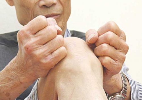 Bệnh xương khớp