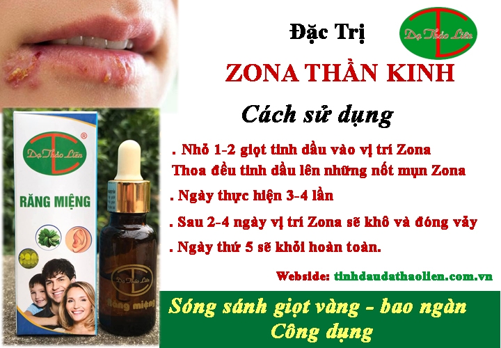 Bệnh zona thần kinh
