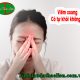 Viêm xoang có tự khỏi được không