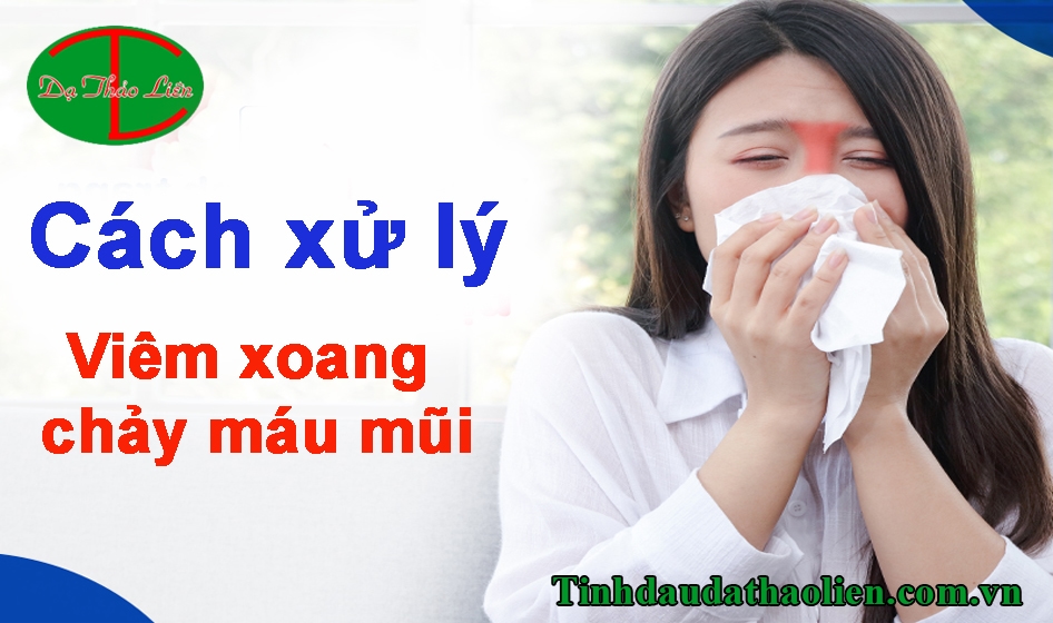 Viêm xoang chảy máu mũi