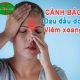 đau đầu do viêm xoang