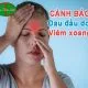đau đầu do viêm xoang