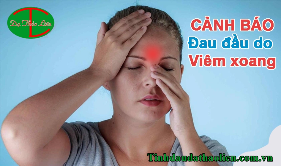 đau đầu do viêm xoang