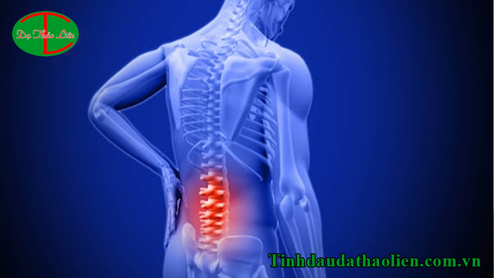C&aacute;ch trị đau lưng