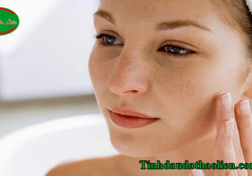 nám da sau sinh có tự hết không