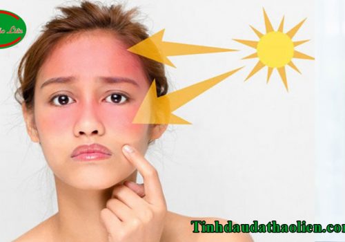 Tác hại của ánh nắng mặt trời đối với làn da