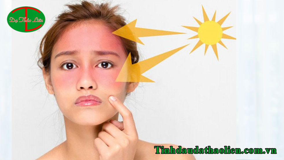 T&aacute;c hại của &aacute;nh nắng mặt trời đối với l&agrave;n da