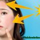 Da bị cháy nắng phải làm sao