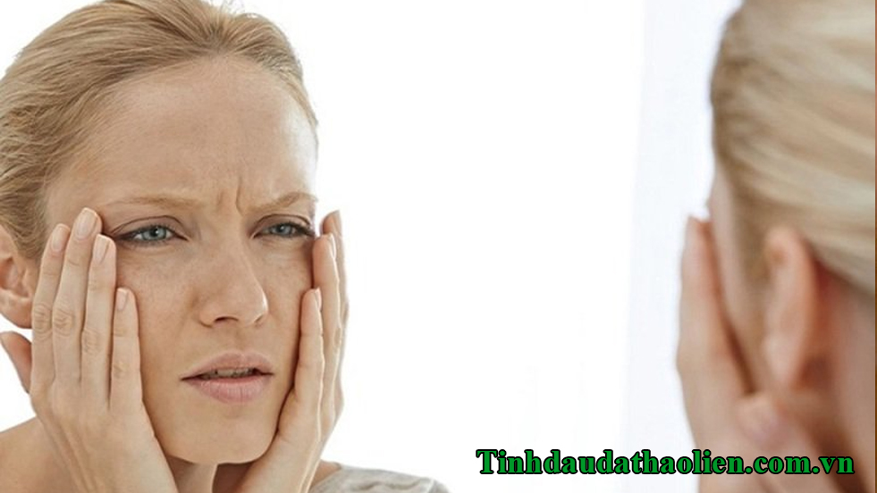 Da bị ch&aacute;y nắng phải l&agrave;m sao